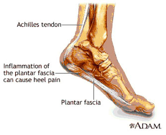 John Bouma can heal your Plantar Fascitis